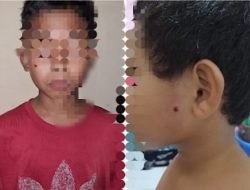 Bocah 11 Tahun di Makassar Jadi Korban, Peredaran Senjata Mainan Harus Diawasi Ketat